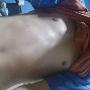 Devid10