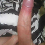kksex